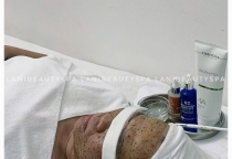 Peel Tảo Lạnh 